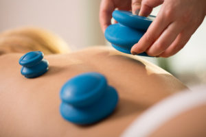 Therapeutic Cupping Workshop 8/2/2020 Olympia, WA